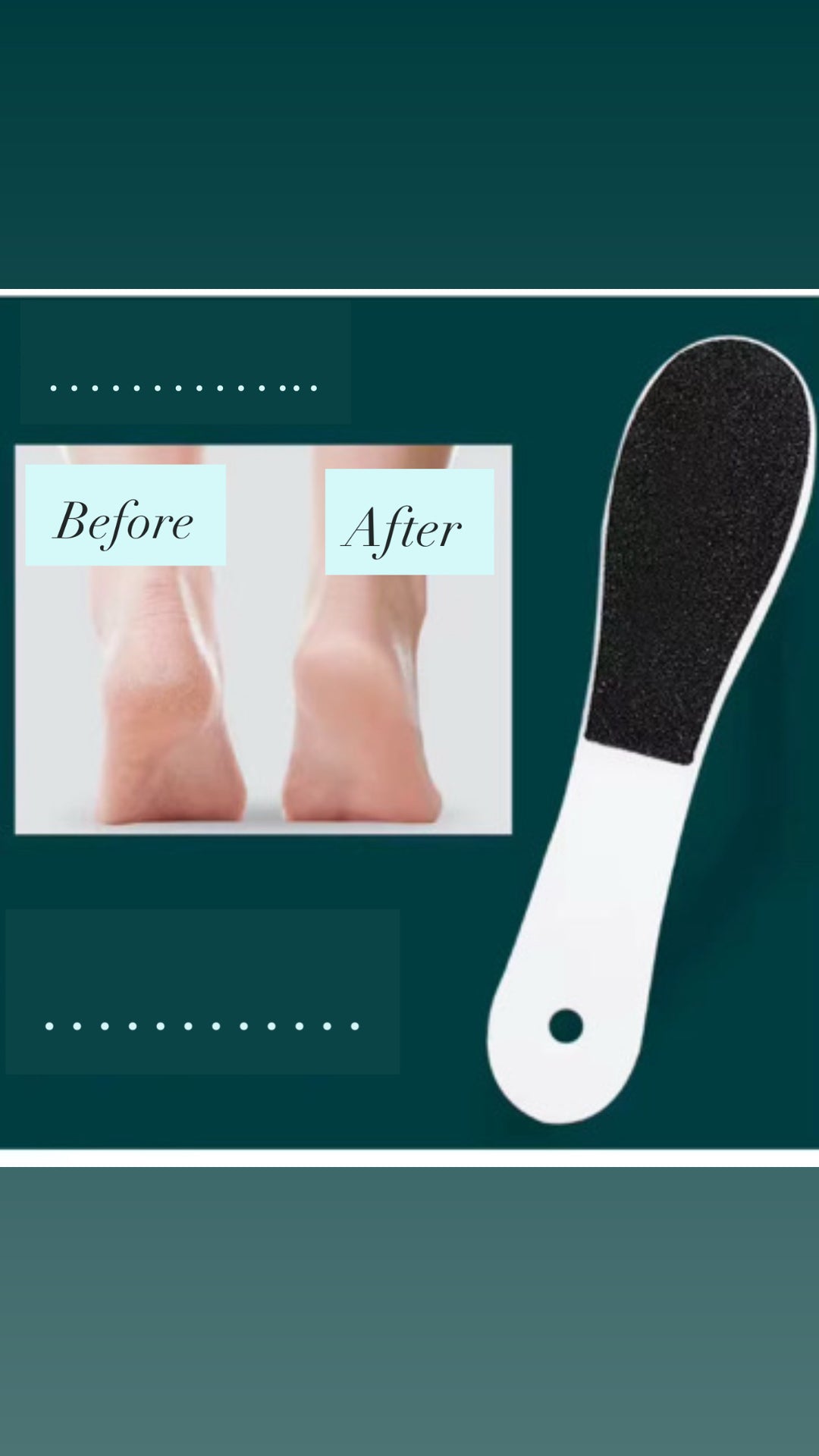 Foot File flexible handle